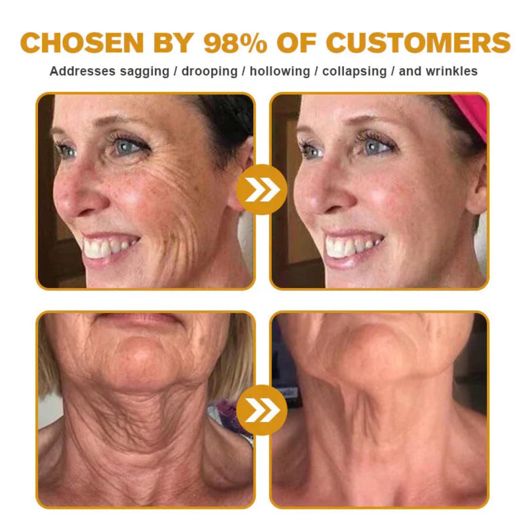 Cream BeeRx™ | Complete Natural Treatment for Psoriasis, Wrinkles and Chronic Skin Diseases!
